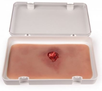  "Wundmoulage Offener Bruch Arm mit Blutungsfunktion"

