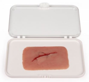 Wundmoulage Schnittwunde mit Glassplitter